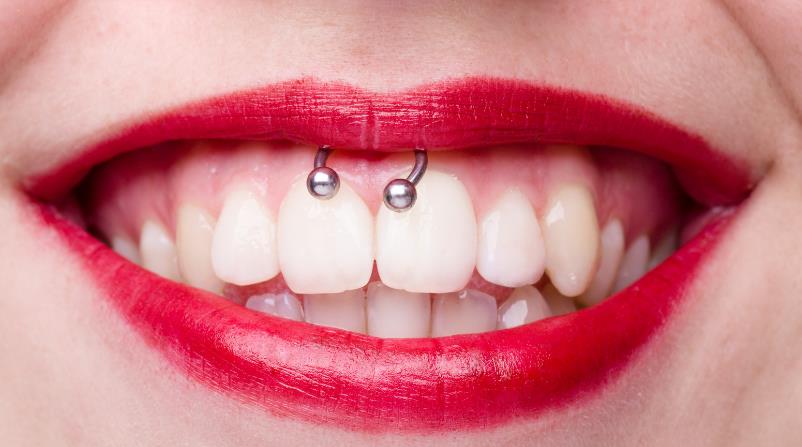 Smiley Piercing